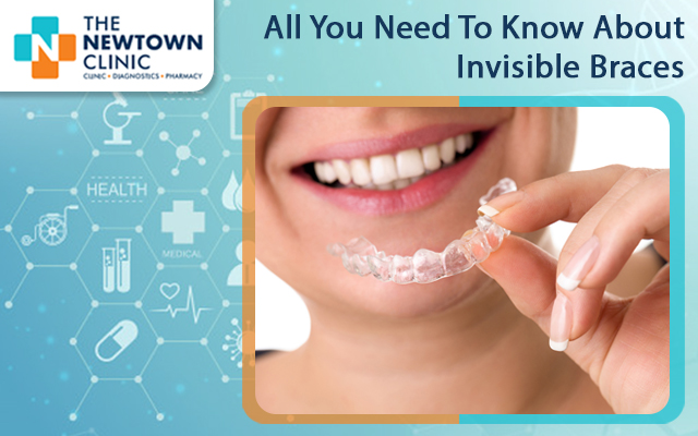 All You Need To Know About Invisible Braces