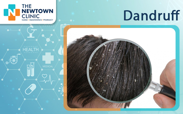 Dandruff