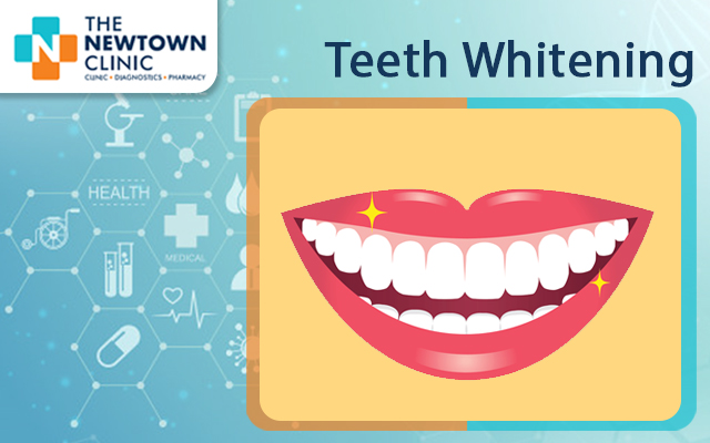 All About Teeth Whitening