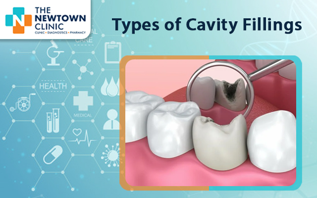 Types of Cavity Fillings Done at the Best Dental Clinic