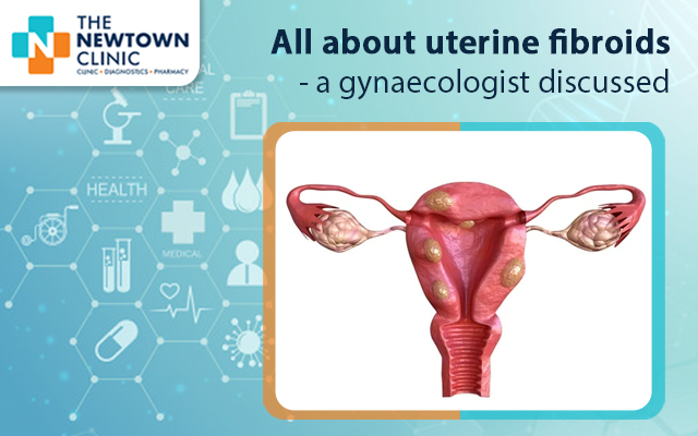 All about uterine fibroids- a gynaecologist discussed