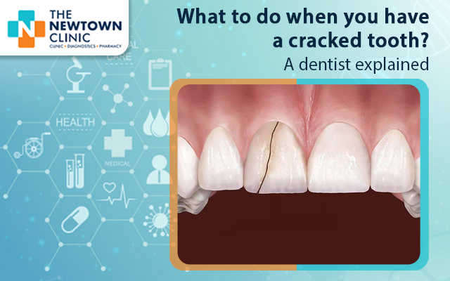 What to do when you have a cracked tooth? A dentist explained