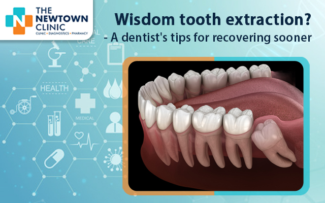 Wisdom tooth extraction?- A dentist’s tips for recovering sooner