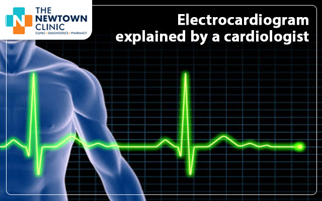 Electrocardiogram explained by a cardiologist