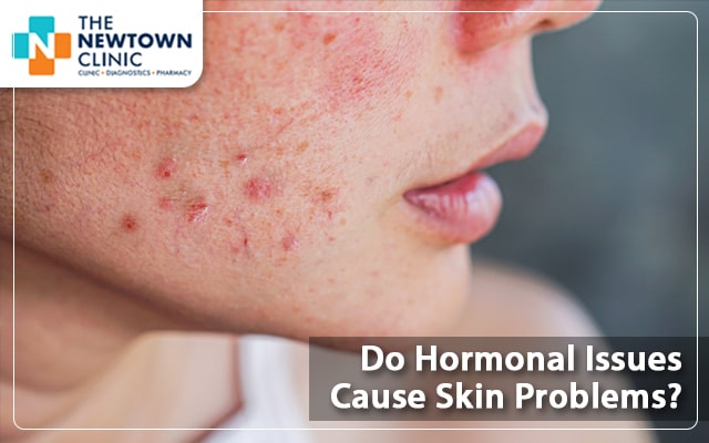 Do Hormonal Issues Cause Skin Problems?