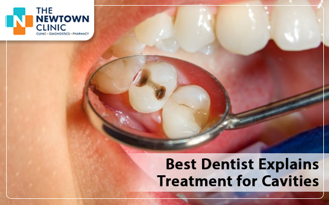 Best Dentist Explains Treatment for Cavities