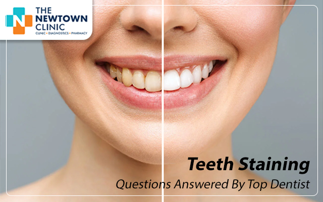 Teeth Staining Questions Answered By Top Dentist