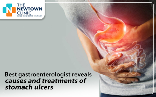 Best Gastroenterologist Reveals Causes and Treatments of Stomach Ulcers