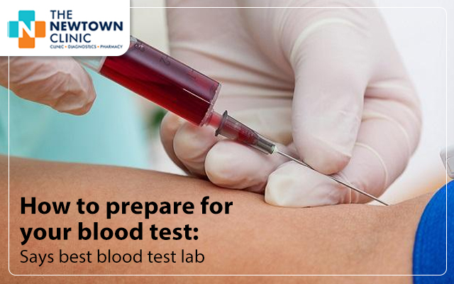 How to prepare for your blood test: Says blood test lab