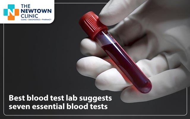 Best blood test lab suggests seven essential blood tests