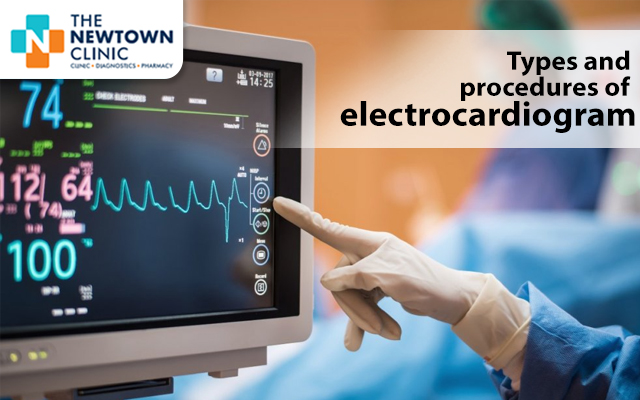 Types and procedures of electrocardiogram