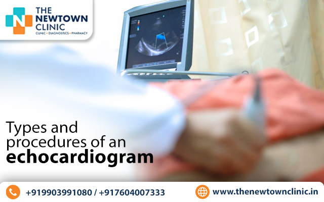 Types and Procedures of an Echocardiogram