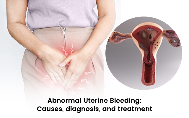 Abnormal Uterine Bleeding: Causes, Diagnosis, and Treatment