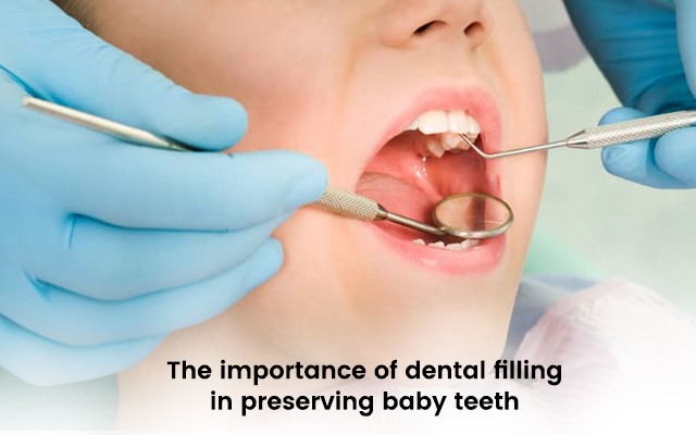 The Importance of Dental Filling in Preserving Baby Teeth