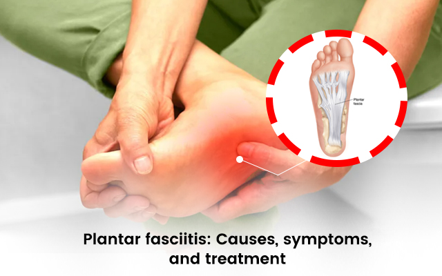 Plantar Fasciitis: Causes, Symptoms, and Treatment