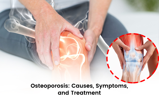 Osteoporosis: Causes, Symptoms, and Treatment Explain Orthopedic Clinic