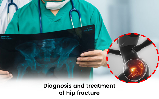 Diagnosis and Treatment of Hip Fracture