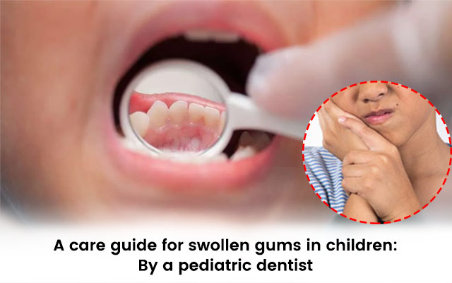 A care guide for swollen gums in children: By a pediatric dentist