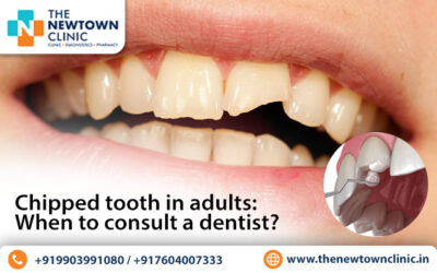 Chipped Tooth in Adults: When to Consult a Dentist?