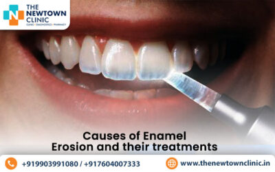 Causes of Enamel Erosion and Their Treatments