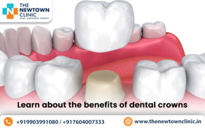 Learn about the benefits of dental crowns