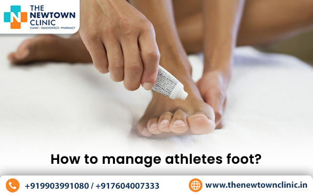 How to manage an athlete’s foot?