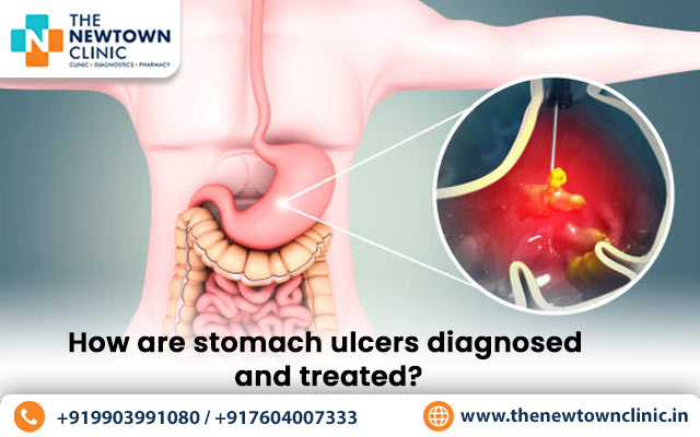 How are stomach ulcers diagnosed and treated?