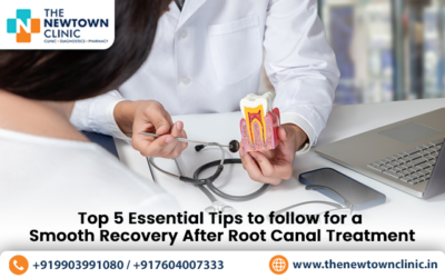 Top 5 Essential Tips to follow for a Smooth Recovery After Root Canal Treatment