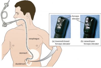 Best Lower GI Endoscopy lab in Newtown