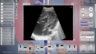 Best Ultrasound (USG) Test in Newtown