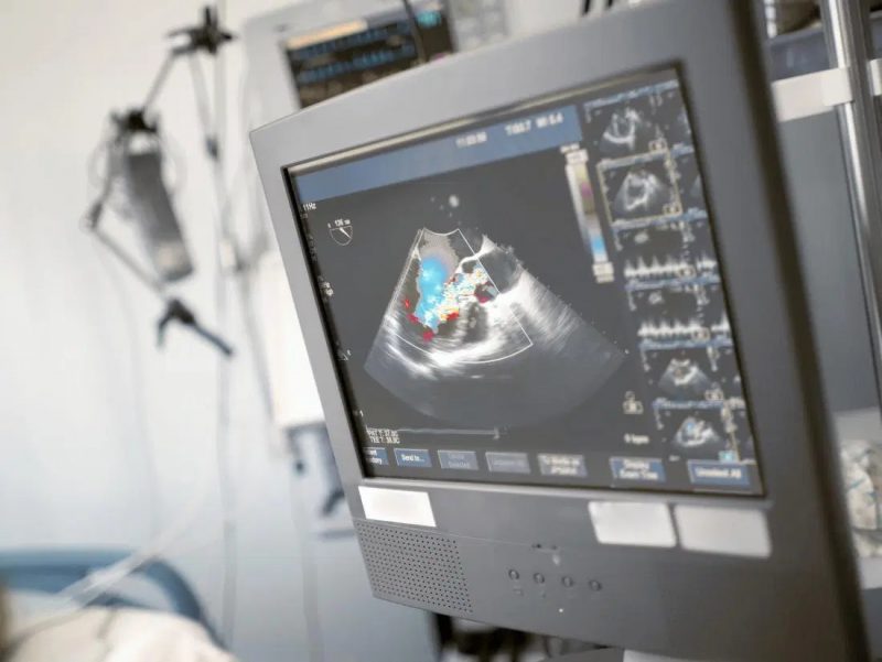 Best Echocardiogram lab in Newtown