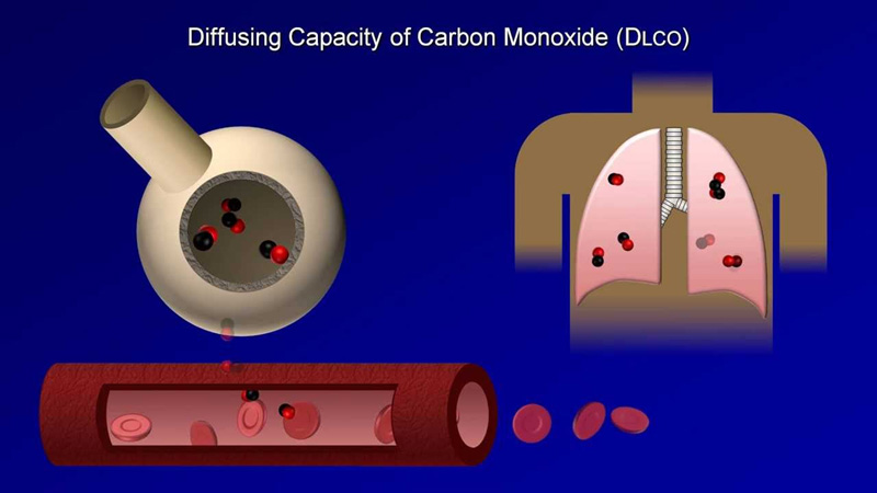 Best Pulmonary Function Tests (PFT) lab in Newtown