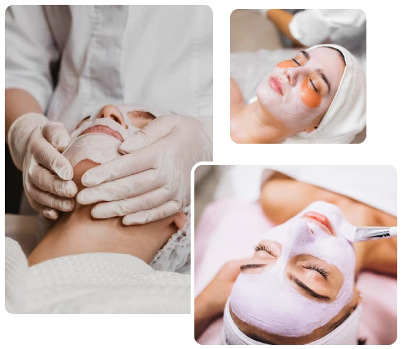 Benefits of Chemical Peeling