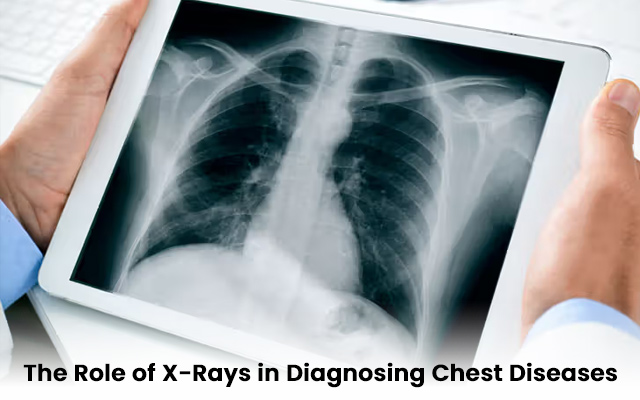 x ray of chest