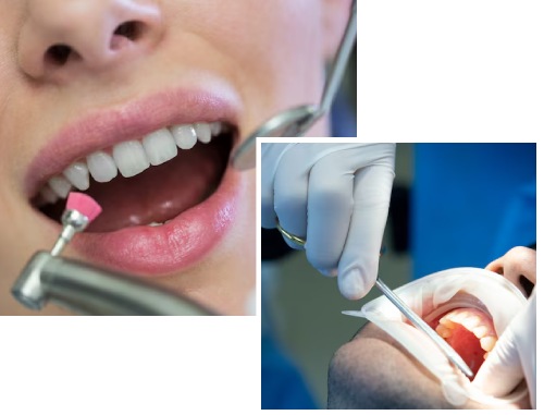 Common Conditions Treated By Our Dentists