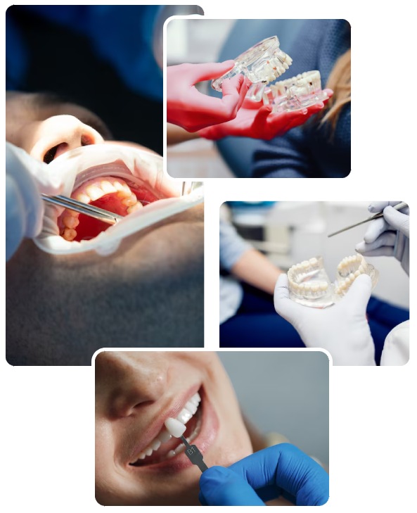 Dental Implants Treatment Procedure