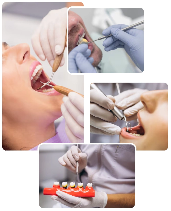 Symptoms of Dental Diseases