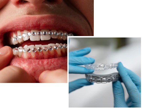 Best Teeth Alignment Clinic in Newtown